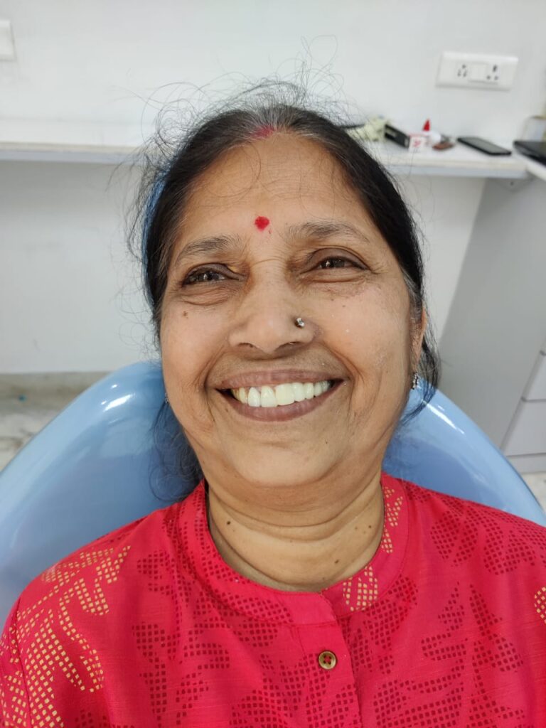One Smile patient transformation 10