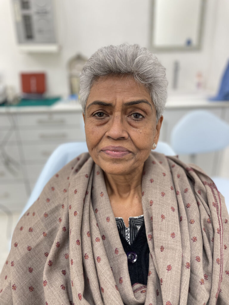 One Smile patient transformation 3