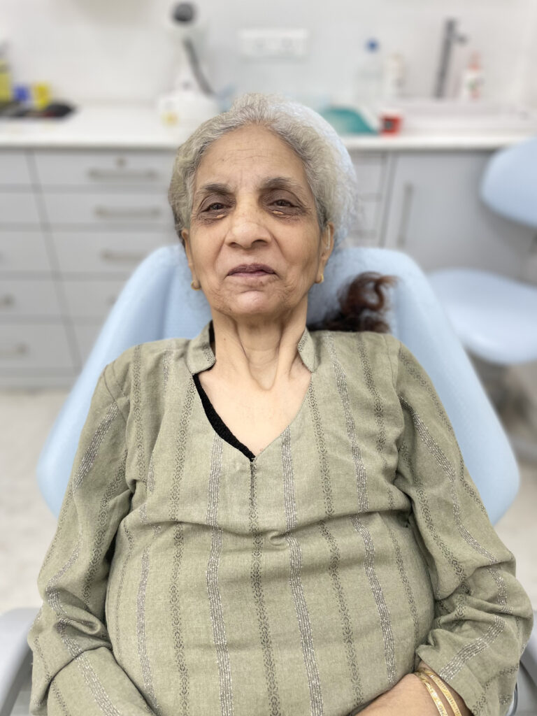 One Smile patient transformation 4