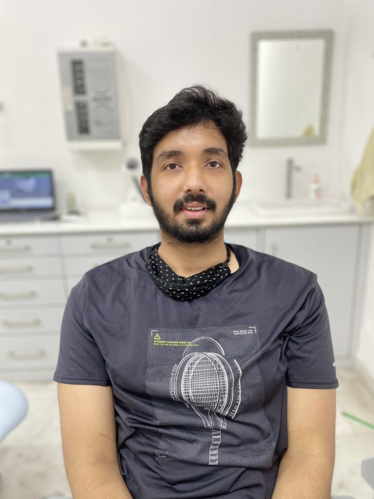 One Smile patient transformation 6