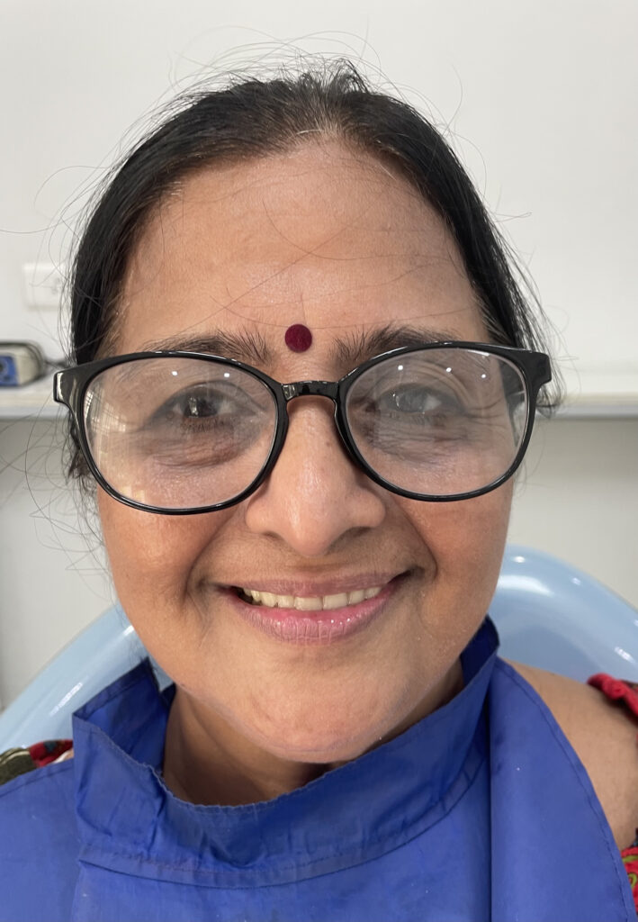 One Smile patient transformation 7