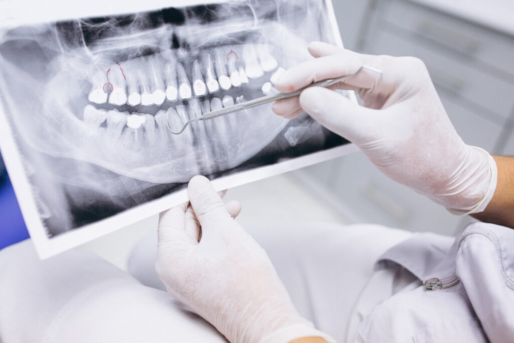 Braces & Clear Aligners